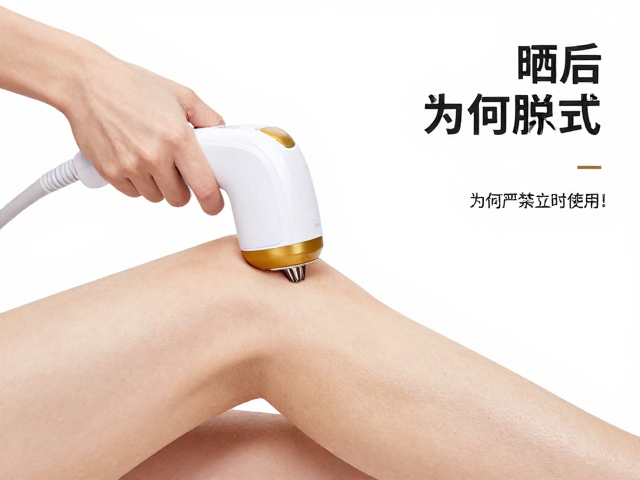 家用全身激光脱毛仪大面积脱毛模式，晒后为何严禁立即使用？