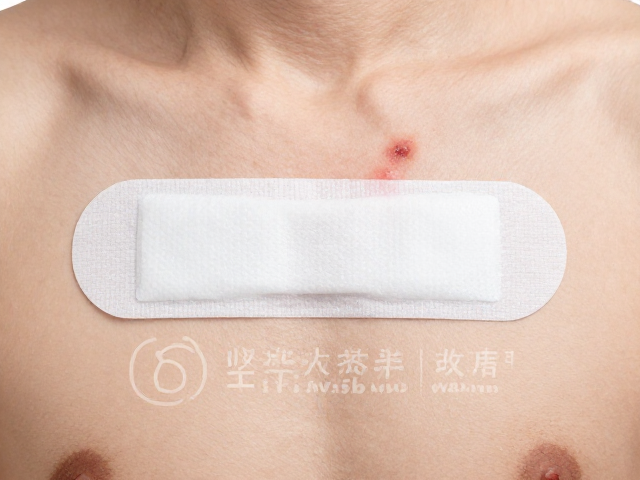 外伤疤痕护理的全周期管理策略