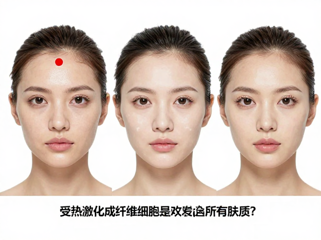 不同肤质对热能的耐受度差异分析
