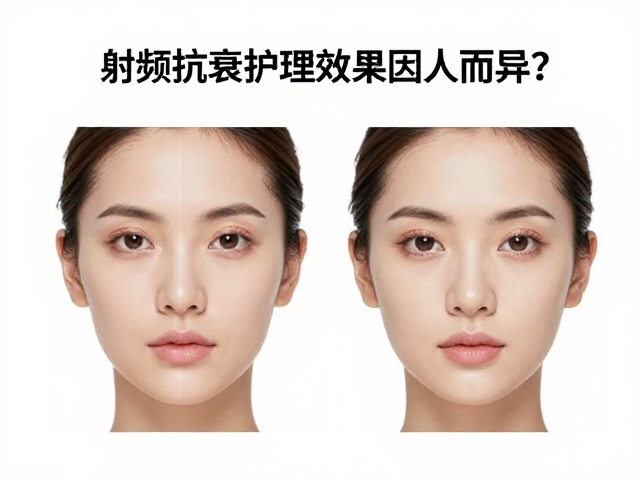 射频抗衰护理效果因人而异？结合肤质淡化面部细纹全攻略
