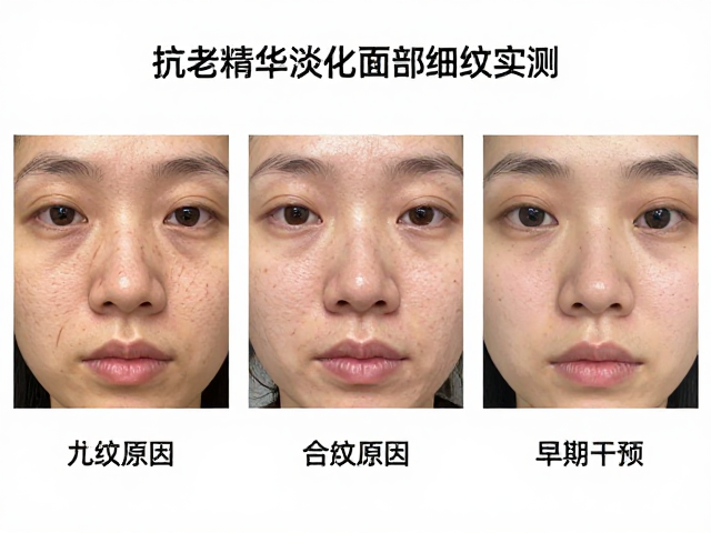 细纹明显人群必看！3款抗老精华淡化面部细纹实测