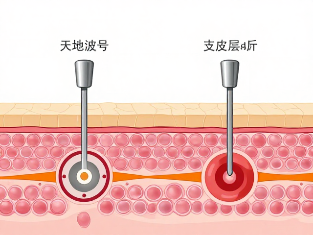 油性肌护肤，光波波长如何作用于真皮层改善肤质