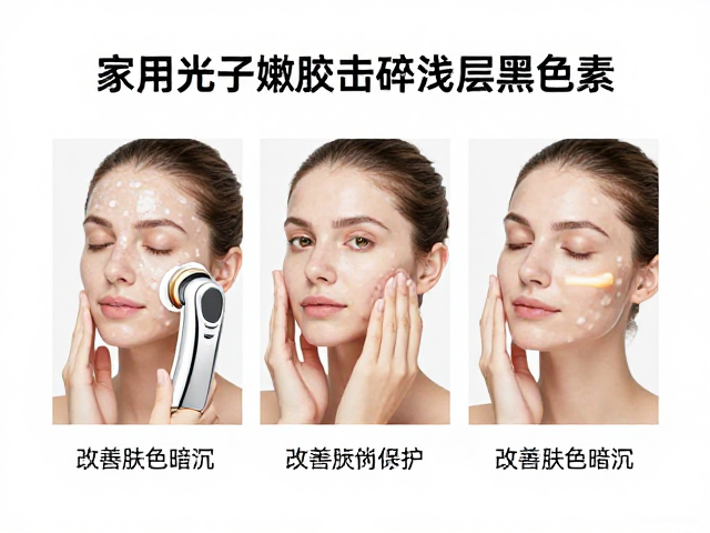 建立科学的预处理与屏障保护流程