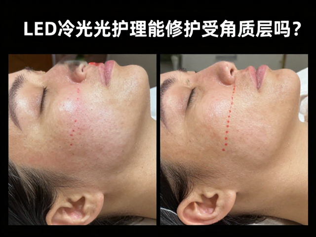 美容院LED冷光护理能修护受损角质层吗？效果与原理全解析