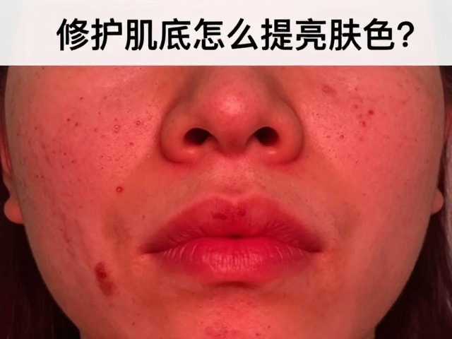 红光修护肌底怎么提亮肤色？实测痘痘数量变化全解析