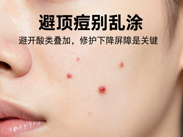 破损痘痘别乱涂！避开酸类叠加，修护下降屏障是关键