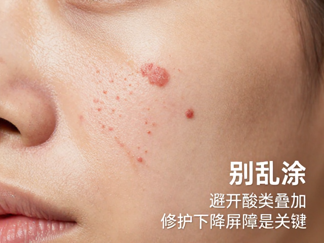 屏障修护的核心逻辑与关键成分