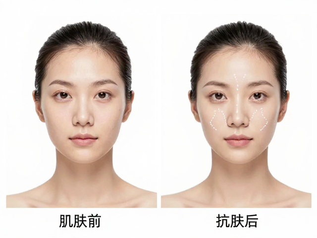 精准定位与基础动作解析