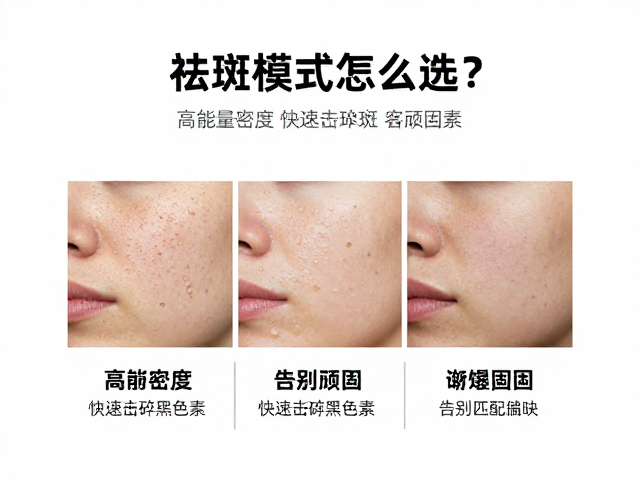 针对不同斑型的精准匹配策略