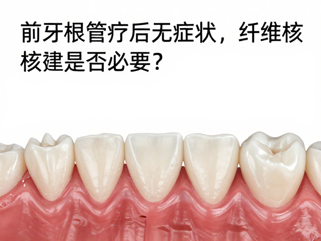 纤维桩核重建的生物力学优势