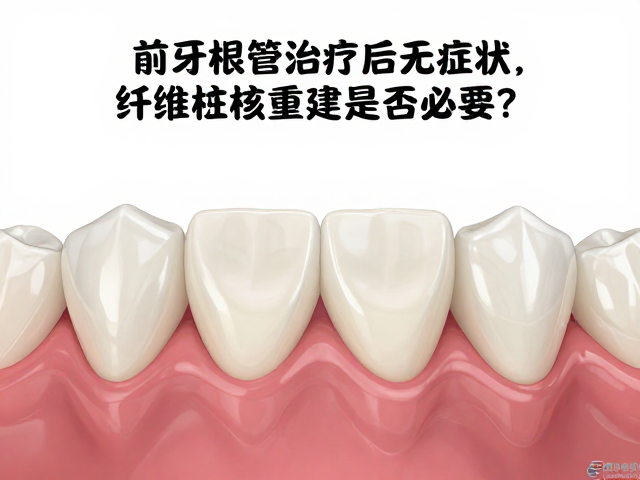 前牙根管治疗后无症状，纤维桩核重建是否必要？专家解读