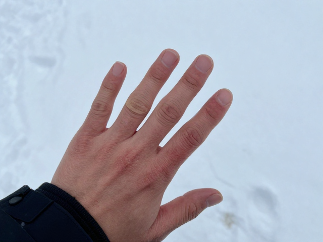 雪地漫步手部冻伤?抗寒贴片护指关节,温暖防冻攻略