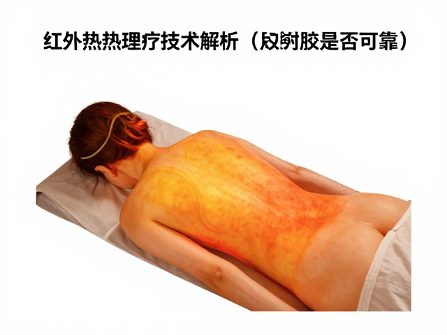 红外热敷理疗技术解析，发热面积与防烫保护是否可靠？