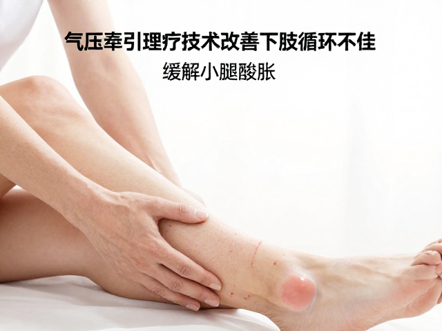 缓解小腿酸胀的综合效益
