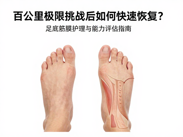 足底筋膜的生物力学特性与物理干预