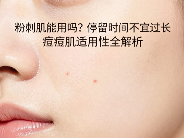 粉刺肌能用吗？停留时间不宜过长，痘痘肌适用性全解析