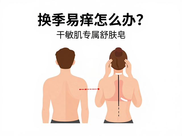 换季易痒怎么办?干敏肌专属舒肤皂,温和止痒修护