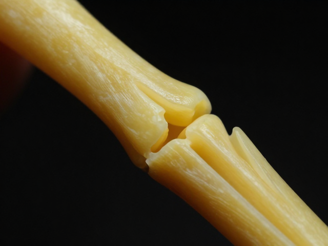 失蜡铸造，活动关节，高可塑性精密零件连接方案