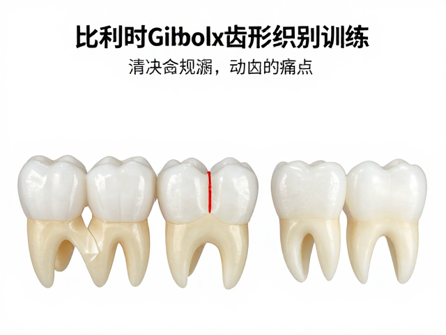 比利时Gibbons齿形识别训练,精准解决漏齿痛点