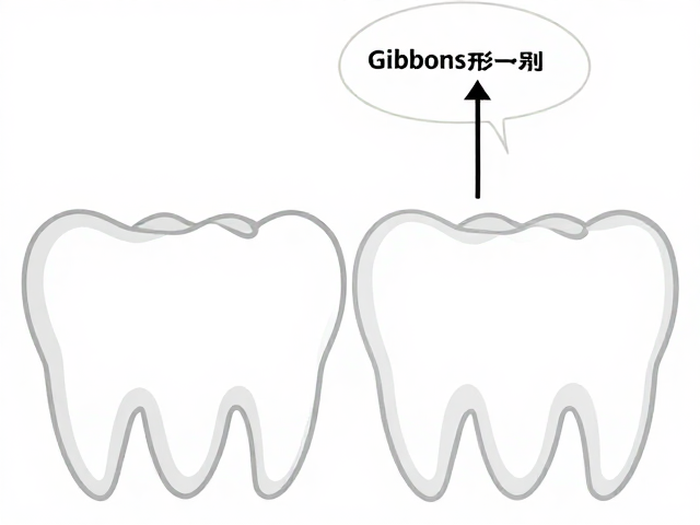比利时Gibbons齿形识别训练,精准解决漏齿痛点
