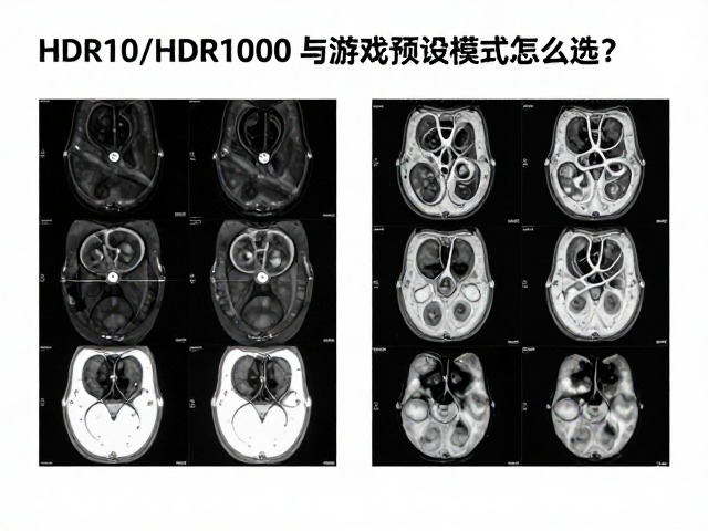 医学影像阅览更清晰,HDR10/HDR1000与游戏预设模式怎么选?