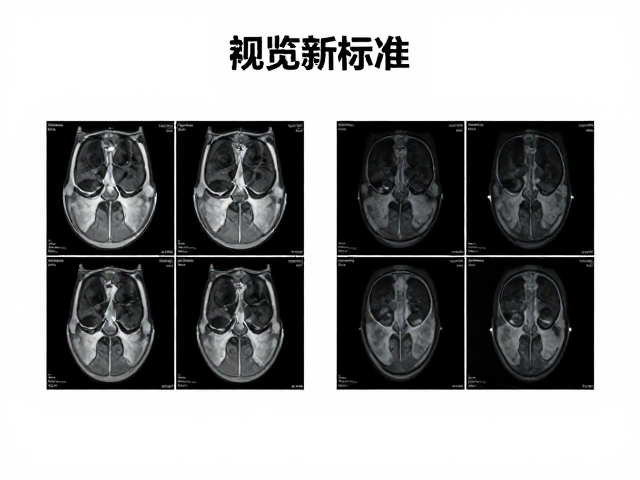 医学影像阅览新标准,HDR1000与PIP画面分割技术解析
