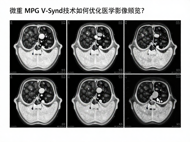 微星MPG V-Sync技术如何优化医学影像阅览?深度解析与实测
