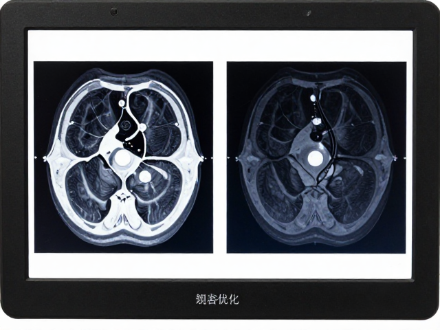 医学影像阅览屏如何优化,调整亮度节能与高效散热通风系统指南