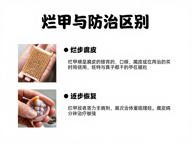 烂甲与腐皮区别,腐皮病防治指南,逐步恢复互动