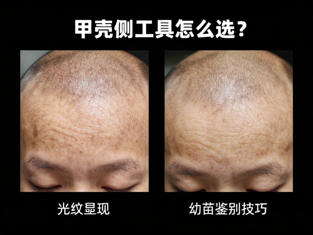 甲壳测量工具怎么选?光照如何影响头纹显现?附幼苗鉴别技巧