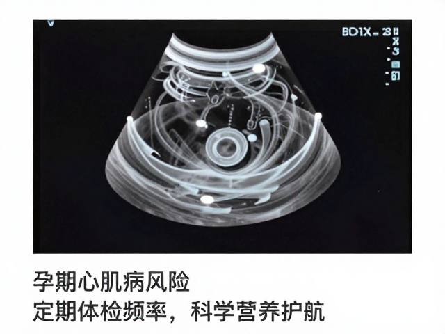 孕期心肌病风险,增加定期体检频率,科学营养护航