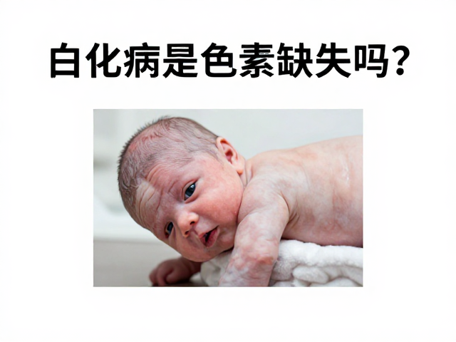 白化病是色素缺失吗?揭秘albino原色缺失原理与特征