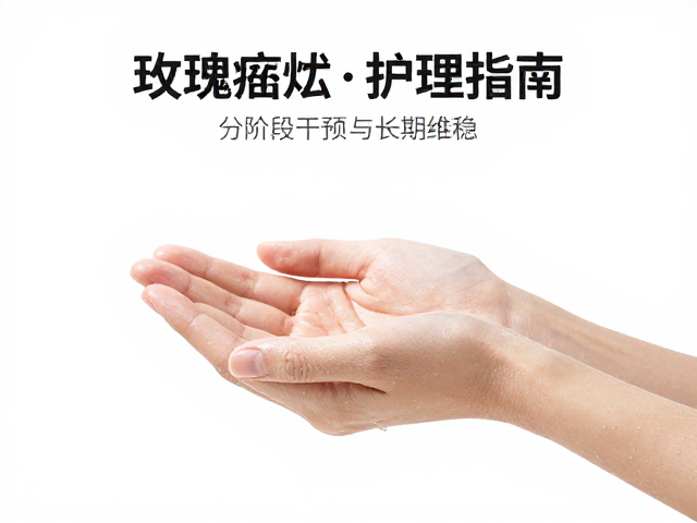 双手托持法,喷雾保湿,玫瑰痤疮蜕皮护理指南