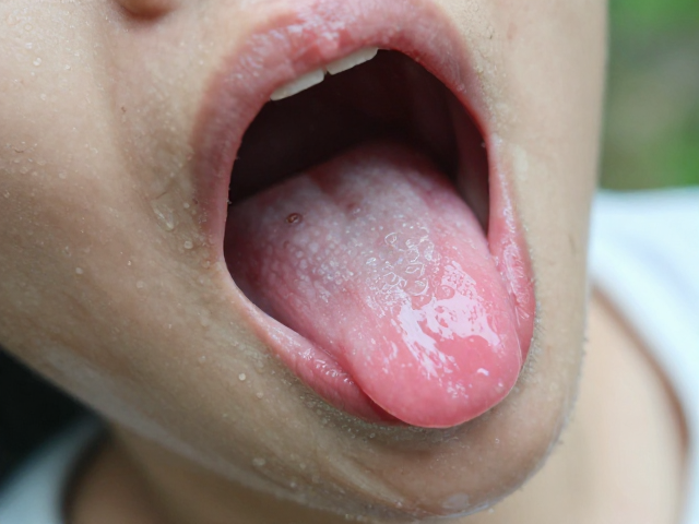 潮湿山区幼体挑选,口腔黏膜粉红辨健康