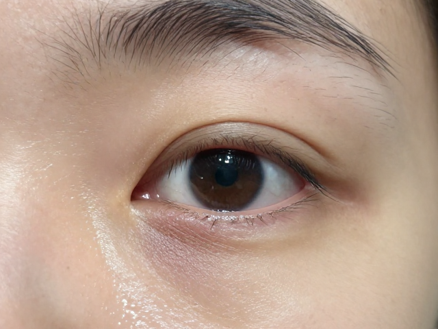 鱼腐皮病怎么治?眼睛浑浊肿胀需定期健康检查