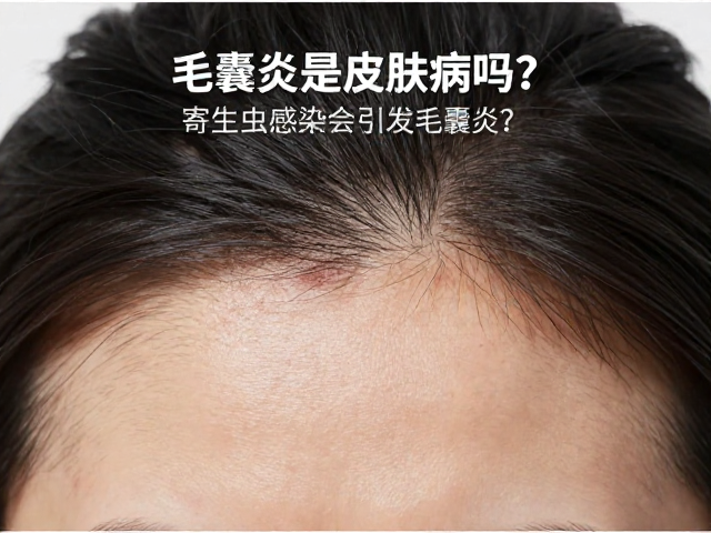 毛囊炎是皮肤病吗?寄生虫感染会引发毛囊炎?防治指南来了