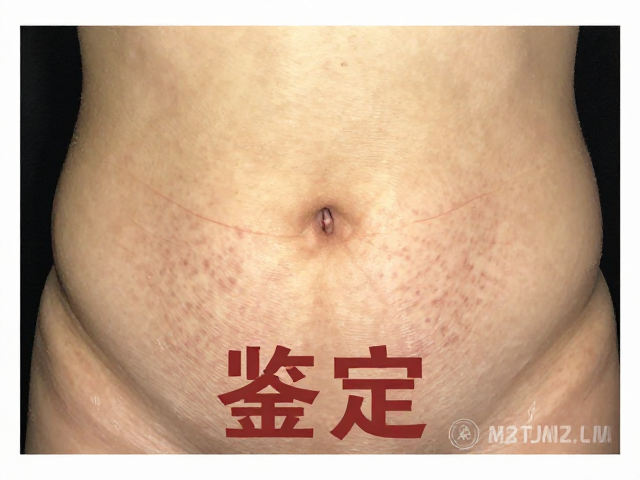 品相标准鉴定，强光手电观察腹部斑纹清晰，一眼辨真伪