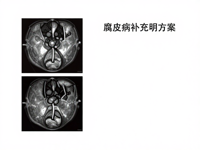 腐皮病防治,电解质补充剂,影像学辅助检查的科学方案