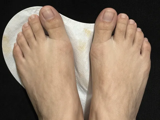足底回弹软垫前掌受力不均？清除背胶残留全攻略
